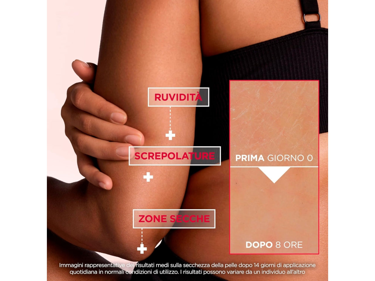 MIXA CICA UREA CREMA RIPARATRICE LEVIGANTE PER PELLI SECCHE 400ML