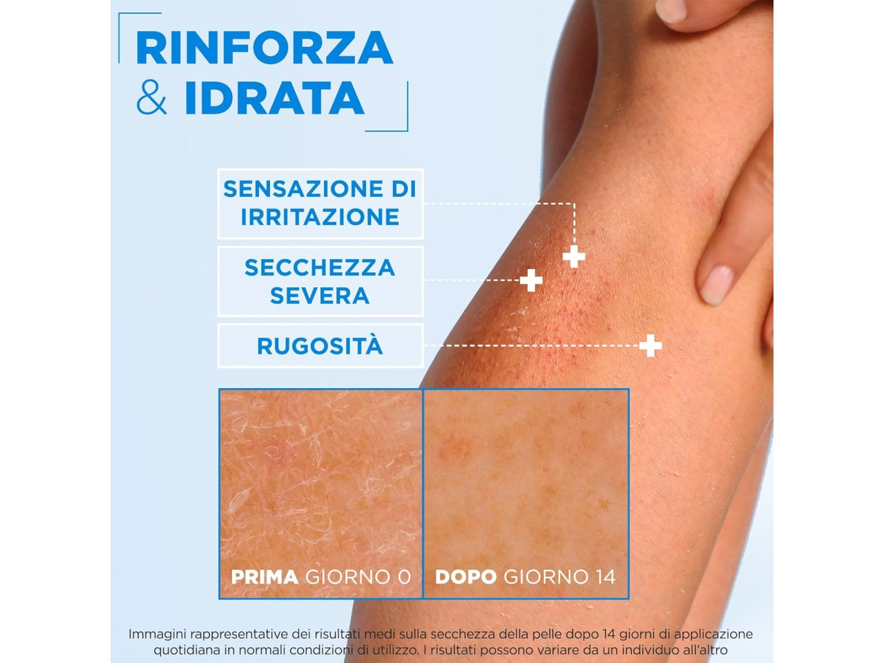 MIXA CERAMIDES CREMA CORPO IDRATANTE RINFORZANTE PER PELLI MOLTO SECCHE 400ML